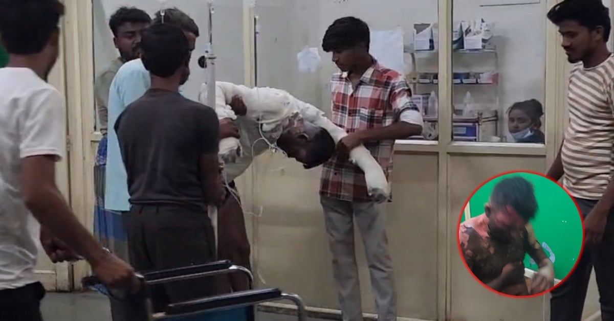 त्योहार की तैयारियों के बीच सनसनी: सिरफिरे ने पेट्रोल छिड़ककर लगाई आग, 4 लोग झुलसे; पीड़ित परिवार ने पुलिस पर लगाए गंभीर आरोप