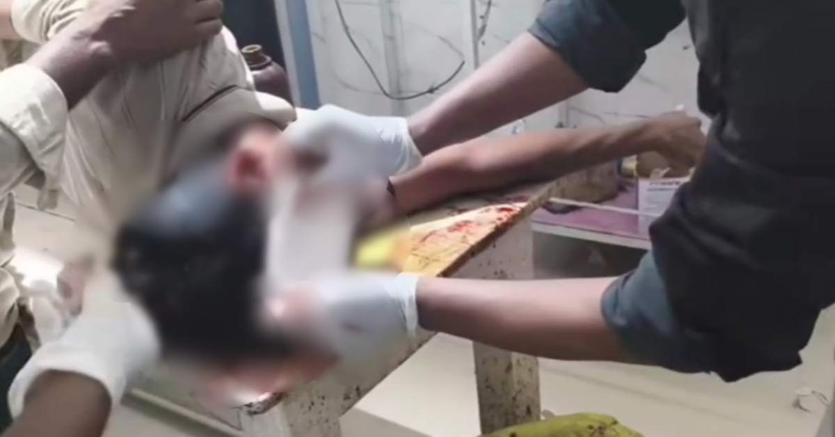 स्कूली बच्चों के सामने खून से लथपथ हुआ ऑटो चालक! मामूली ओवरटेक विवाद में चाकू से किया जानलेवा हमला
