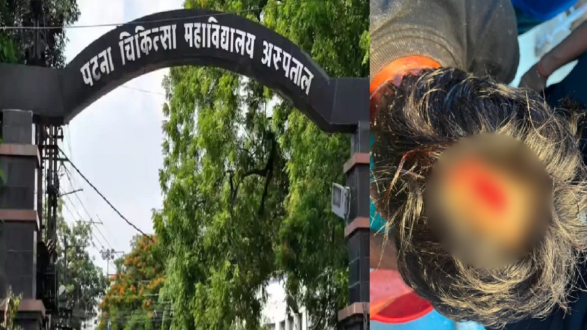 PMCH में इंटर्न डॉक्टर पर लोहे की रॉड से हमला, विरोध में हड़ताल पर डॉक्टर, OPD-इमरजेंसी सेवा ठप