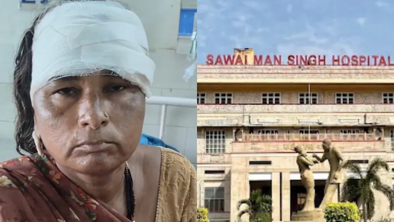 सिर पर गिरा चलता पंखा, खून बहता रहा, SMS Hospital में एंबुलेंस के लिए आधे घंटे इंतजार का आरोप