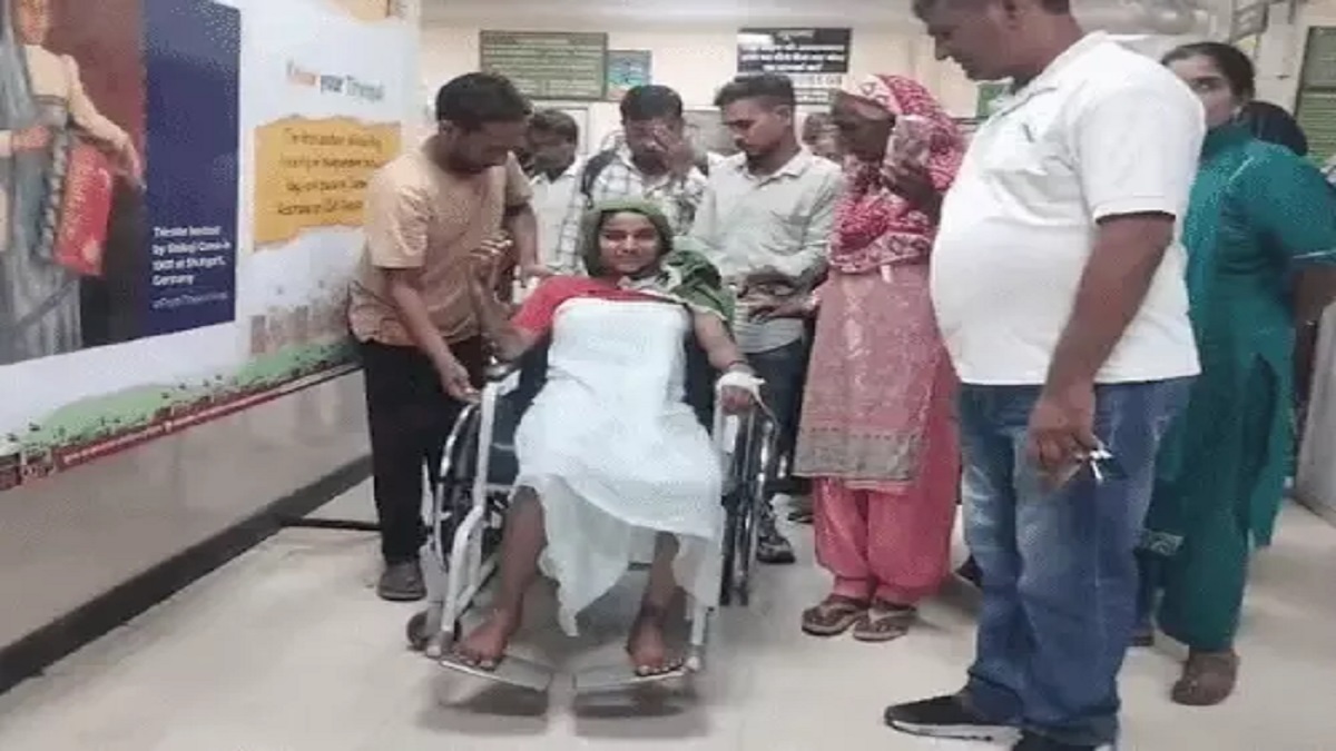खौलता पानी डालकर युवती को जलाया: 3 लाख में बुजुर्ग से शादी का विरोध करने पर वारदात, ICU में भर्ती