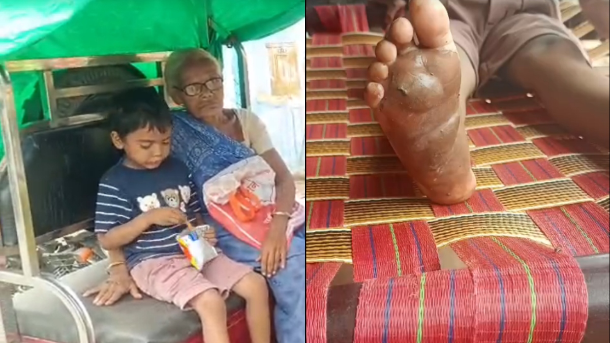 5 रुपये के लिए मां ने मासूम को पीटा, गर्म चाकू से दागे तलवे; 3 दिन तक कमरे में बंद रखा