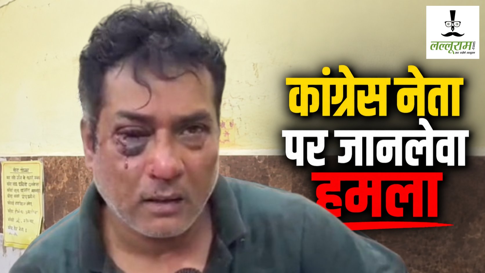 कांग्रेस नेता पर जानलेवा हमला : बदमाशों ने घर घुसकर की मारपीट, भाजपा नेता पर लगा आरोप