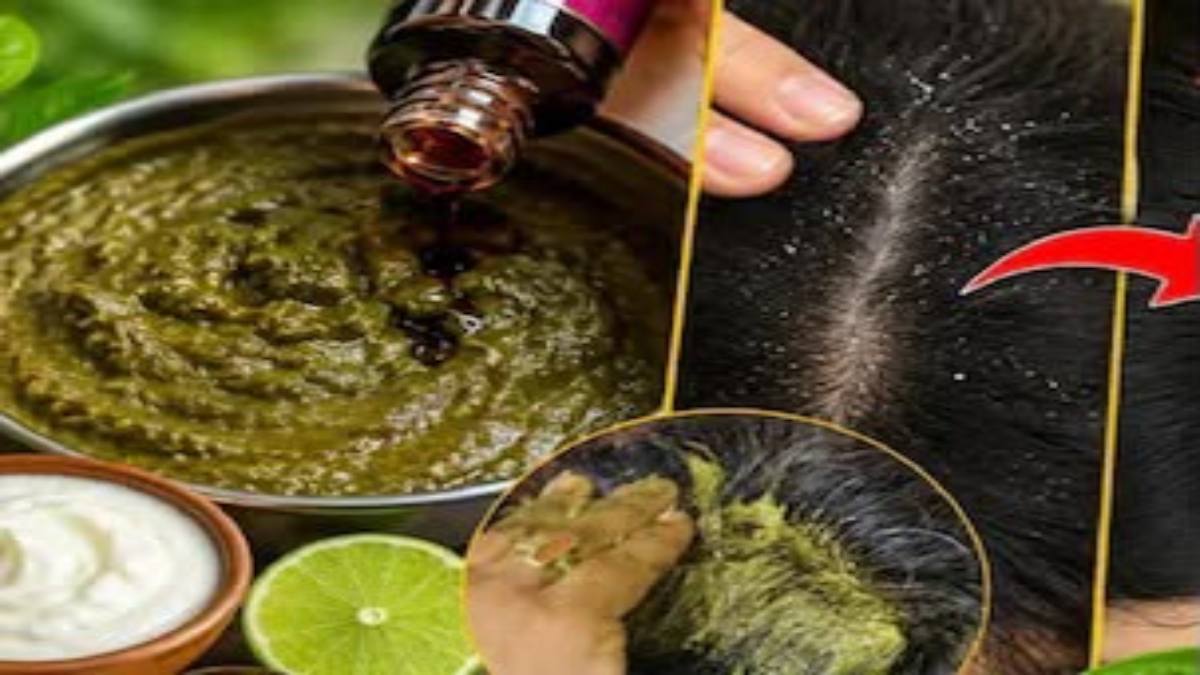 बरसात में बढ़ गई है रूसी और स्कैल्प की खुजली? दही, नींबू, मेहंदी और तेल से बना हेयर पैक आ सकता है काम …