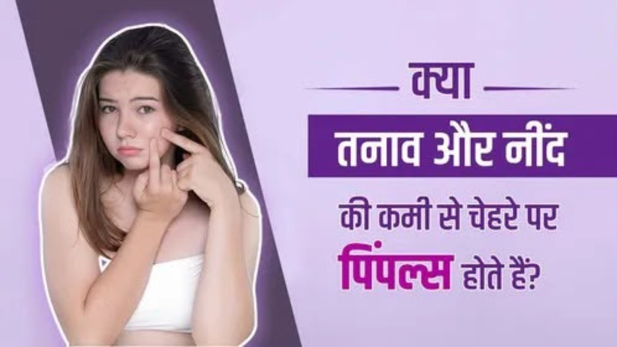 बार-बार चेहरे पर निकल रहे हैं पिंपल्स, तनाव और नींद की कमी भी हो सकती है वजह