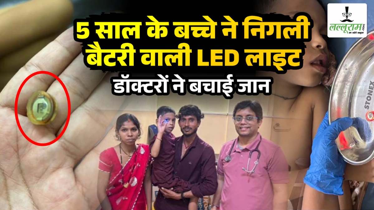 Chhattisgarh : 5 साल के बच्चे ने निगली बैटरी वाली LED लाइट, डॉक्टरों ने एंडोस्कोपी से निकाला, समय पर इलाज नहीं मिलने से जा सकती थी जान