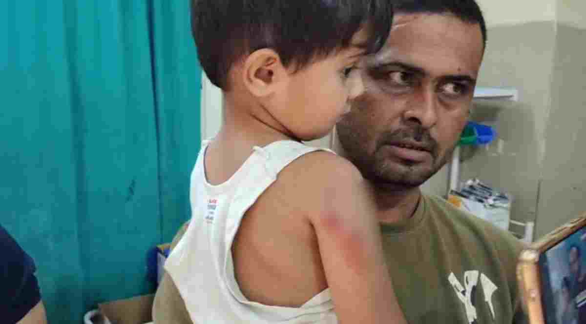 शाजापुर में आवारा कुत्तों का आतंक, हमले में 5 लोग घायल, इलाके में फैली में दहशत
