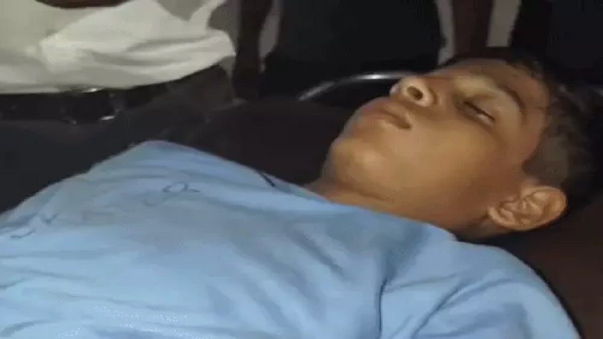 पिटबुल का खौफनाक हमला! दोस्त से बात कर रहे छात्र को 16 जगह काटा, अस्पताल से हुआ रेफर