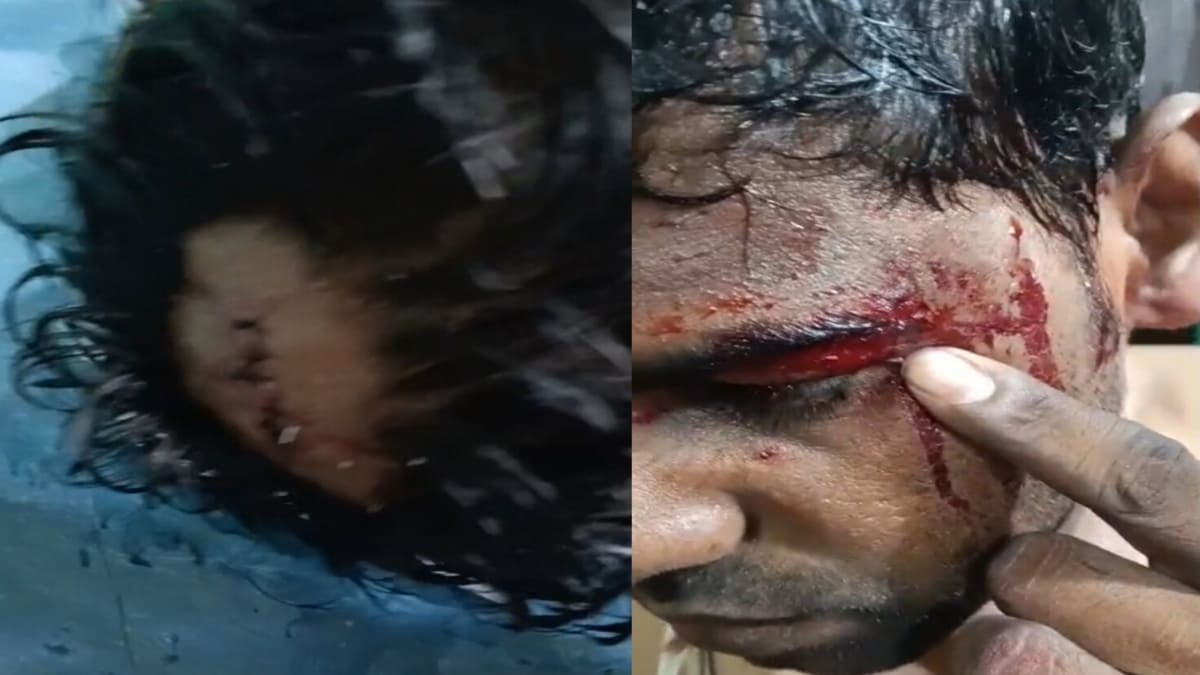 मोतिहारी में डायन का आरोप लगाकर मां-बेटे पर जानलेवा हमला, लूटपाट और बाइक छीनने का मामला दर्ज