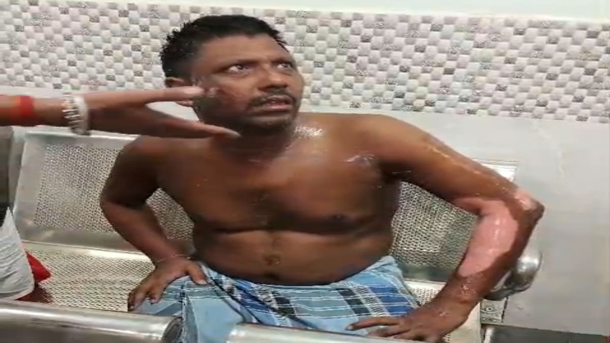 युवक पर पेट्रोल छिड़क कर जलाने की कोशिश, दो झुलसे