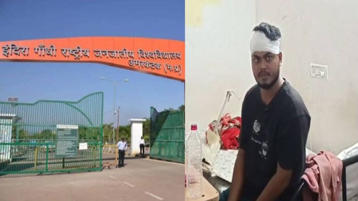 IGNTU अमरकंटक में बड़ा हादसा: हॉस्टल में सो रहे छात्र के सिर पर गिरा सीलिंग फैन, सिर में आई गंभीर चोट