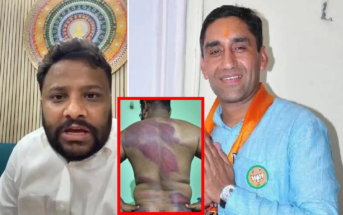 दलित BJP नेता को अंधेरे कमरे में पूरी रात डंडे-बेल्ट से पीटा: पीड़ित ने अपने ही पार्टी के विधायक पर लगाया सनसनीखेज आरोप