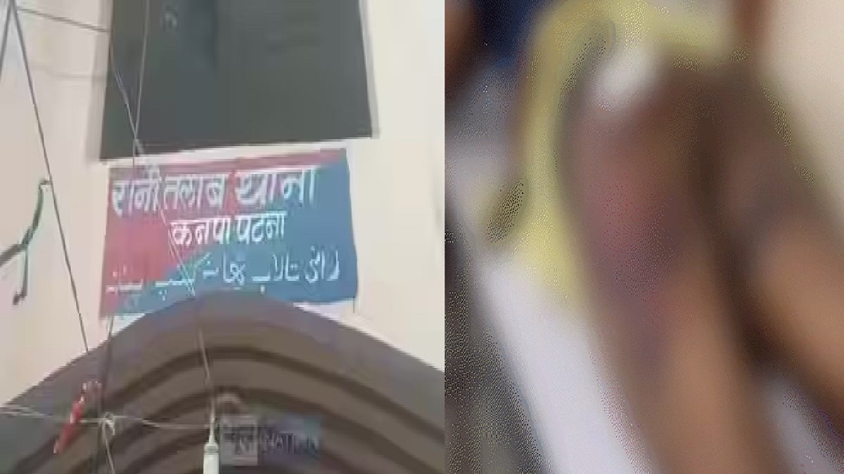 ‘छाती पर पैर रखा, 400 बार पीटा’, आरोपी नहीं मिला तो भाई को उठा ले गई पुलिस, LIC एजेंट की पिटाई