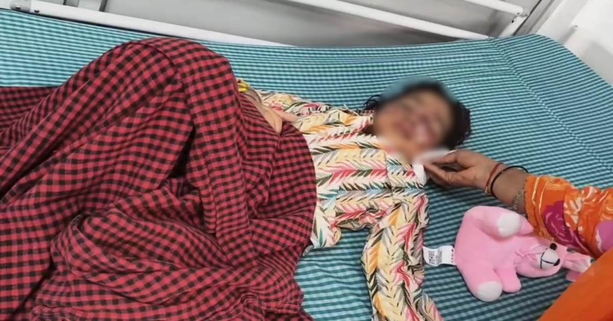 बिल्ली को बचाने गई 4 साल की मासूम को स्ट्रीट डॉग ने नोंचा; गंभीर हालत में सतना रेफर, PICU में भर्ती