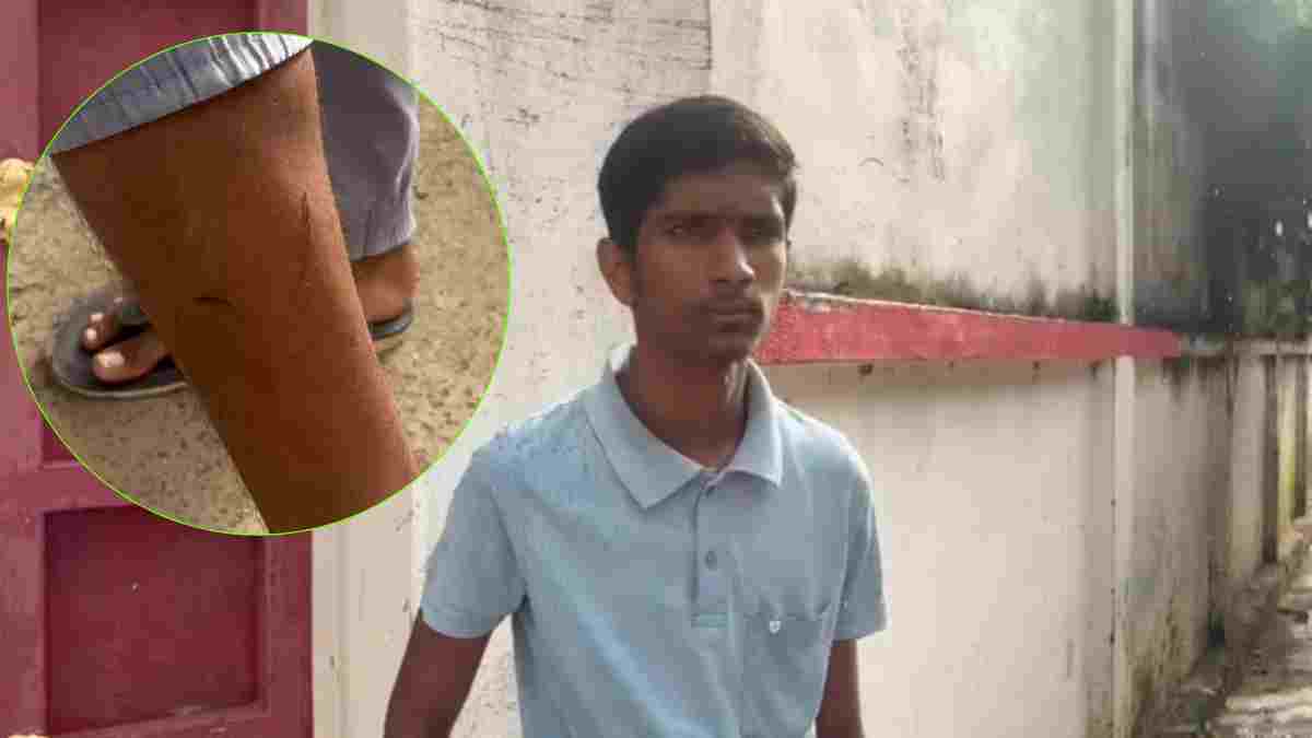 कुत्ते ने काटा तो लगा दिया सांप का इंजेक्शन! संजय गांधी अस्पताल में फिर लापरवाही के आरोप, सीएम हेल्पलाइन में शिकायत