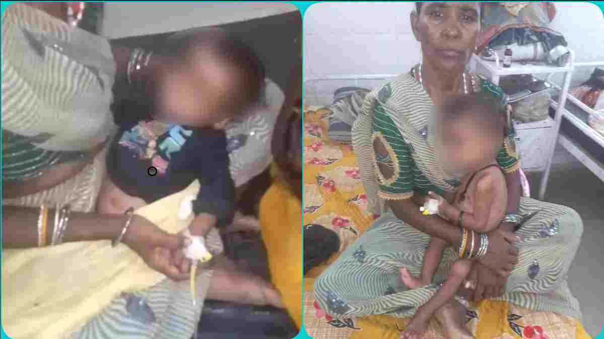 सरकारी कोशिशों के बीच कुपोषण की कड़वी तस्वीर, 2 साल के मासूम का वजन महज 5.6 किलो, दूसरी बार NRC में भर्ती
