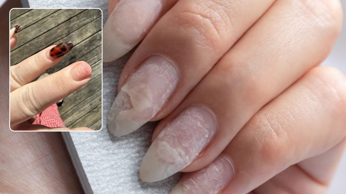 बार-बार Nail Extensions करवाने से कमजोर हो गए नाखून? ऐसे लौटाएं मजबूती