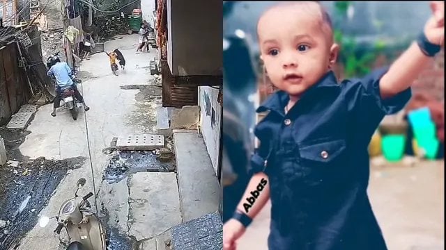 दिल्ली के संगम विहार में आवारा कुत्ते का आतंक, 18 माह के मासूम को बुरी तरह नोचा ; ICU में भर्ती