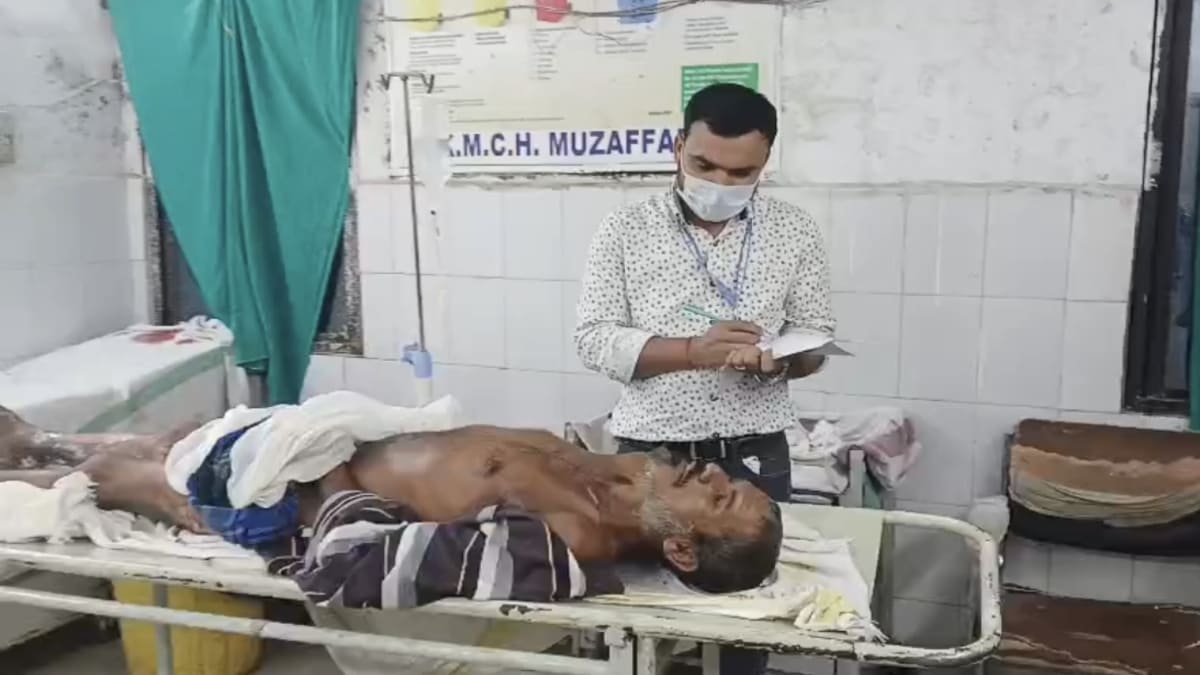 पेट्रोल लीक होने से बाइक में लगी भीषण आग, पिता-पुत्र समेत तीन झुलसे, गंभीर हालत में SKMCH  रेफर
