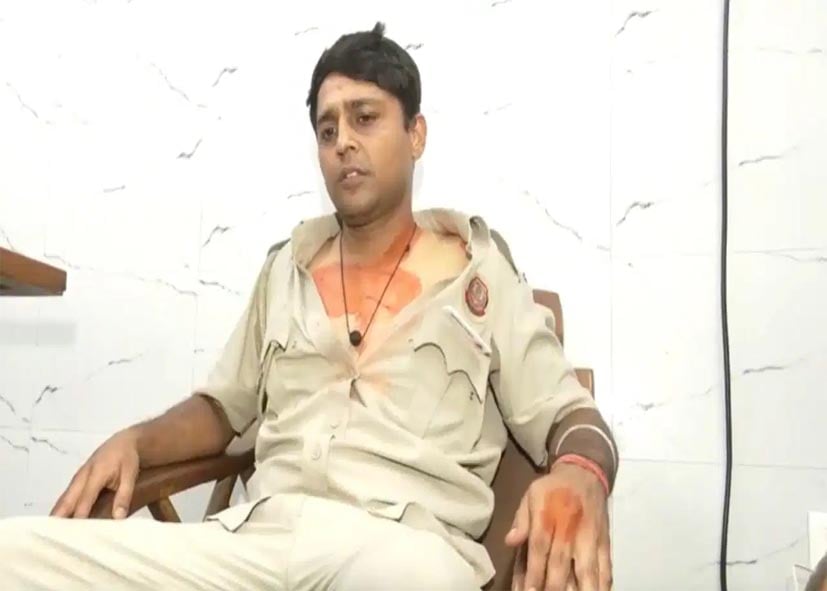 कांग्रेस के प्रदर्शन में पुलिसकर्मी से मारपीट, रोते हुए कॉन्स्टेबल ने सुनाया दर्द