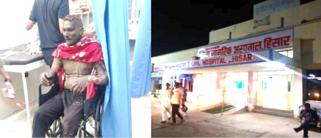 पत्नी से मिलने आधी रात पहुंचा प्रेमी, पति ने दोनों पर पेट्रोल छिड़ककर लगाई आग; खुद भी झुलसा, तीनों ICU में भर्ती