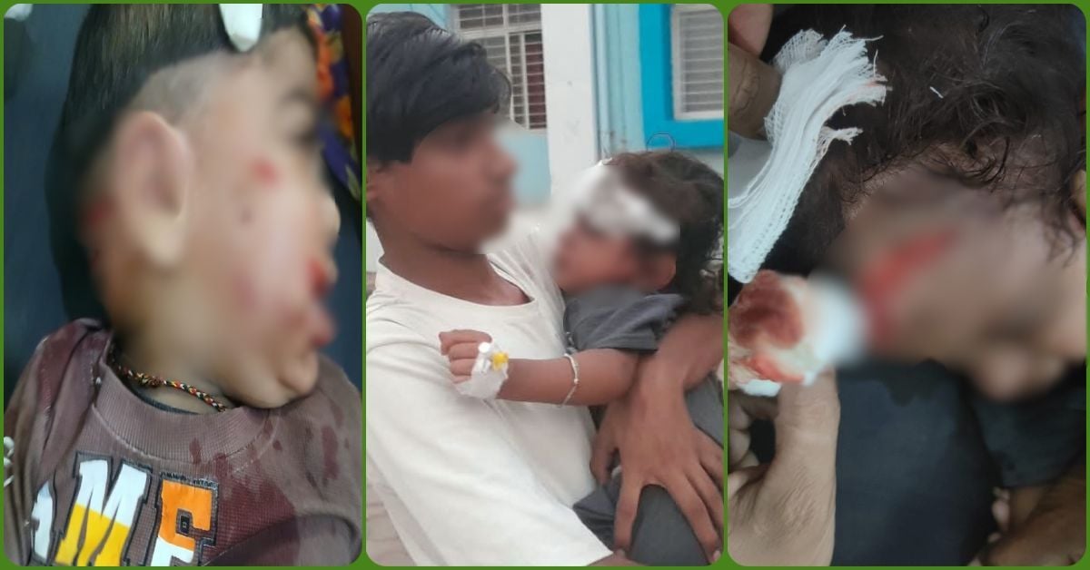खेल रहे बच्चों पर अचानक झपटा पागल कुत्ता, 5 बच्चे घायल, 2 गंभीर हालत में जिला अस्पताल रेफर