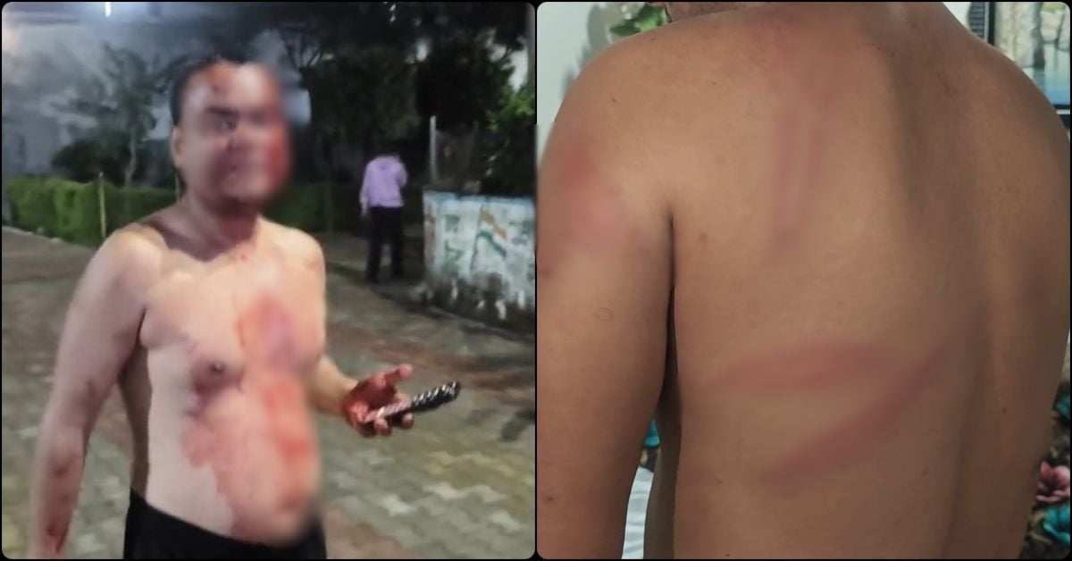 बुढ़ार में खाकी पर गंभीर आरोप: अधिवक्ता को बेरहमी से पीटा, सिर फटा-कान जख्मी; बचाने आए साथियों से भी मारपीट