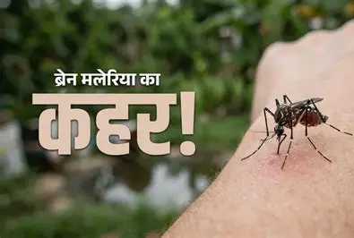 जमशेदपुर में ब्रेन मलेरिया का कहर: 7 दिनों में 4 बच्चों की मौत, वेंटिलेटर पर जिंदगी की जंग हार गया 7 साल का राहुल