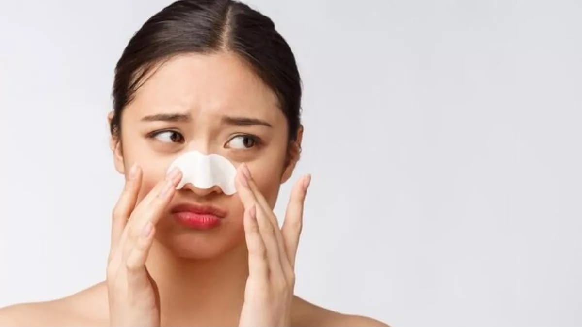 चेहरे पर दिखने लगे हैं व्हाइटहेड्स? यहाँ जानें कैसे पाएं छुटकारा और पायें राहत