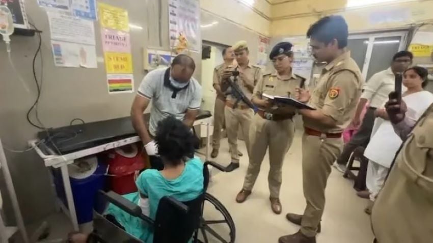 ‘मुझे देखते ही लोग डर जाते हैं…’ कानपुर की झुलसी महिला ने बयां किया हैवान पति का काला सच, जानें पूरा मामला