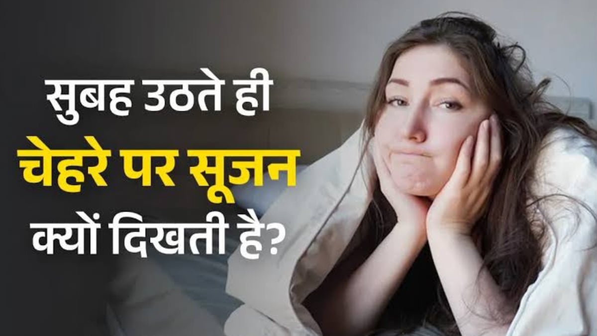 सुबह उठते ही चेहरा सूजा हुआ नजर आता है ? जानें क्या हो सकती है वजह